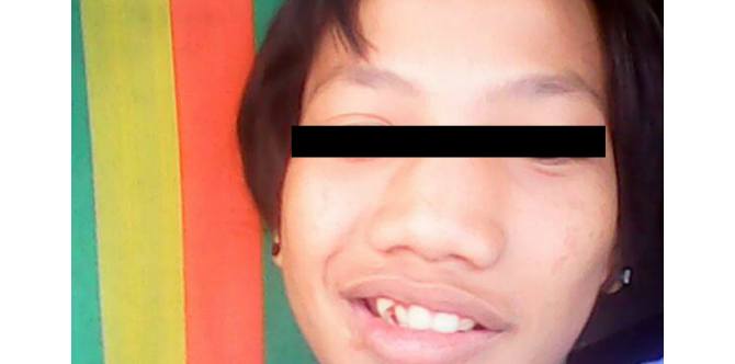 13-Year-old boy shot by motorcycle riding gunman outside his home