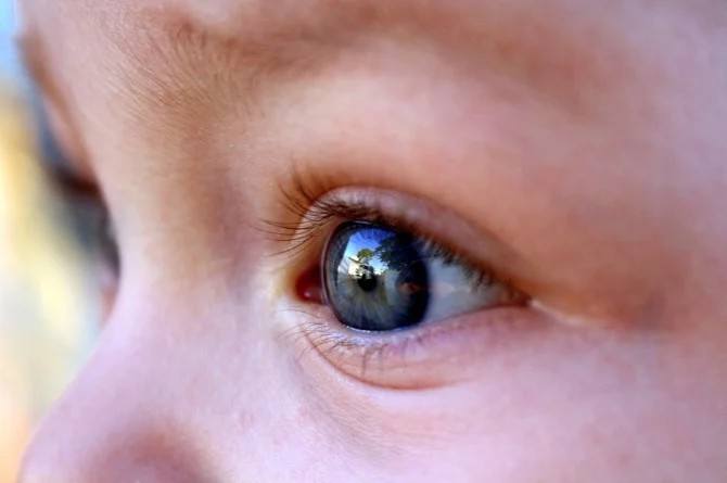 5 signs your child needs an eye check-up now!