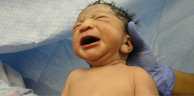 Is there a limit to the number of C-sections women can have?