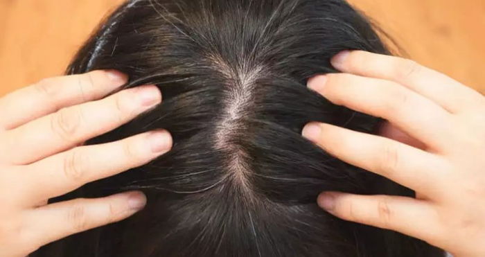 Gray hair in children: "I noticed a strand of grey hair on my daughter. What should I do?"