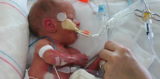 Premature baby problems: 14 Short-term and long-term health issues faced by premature babies