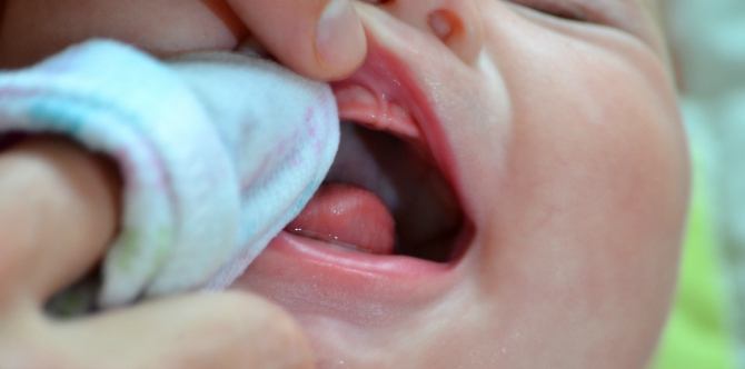 Bad breath ba si baby? Narito ang mga sintomas, sanhi at paggamot dito