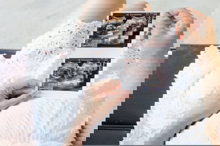 pregnancy ultrasound price philippines