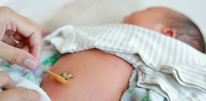 Umbilical cord care: What's normal and what's not