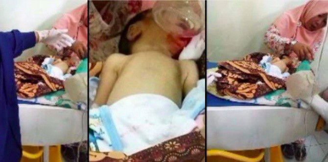Death of a newborn shows why infants should never be fed solids