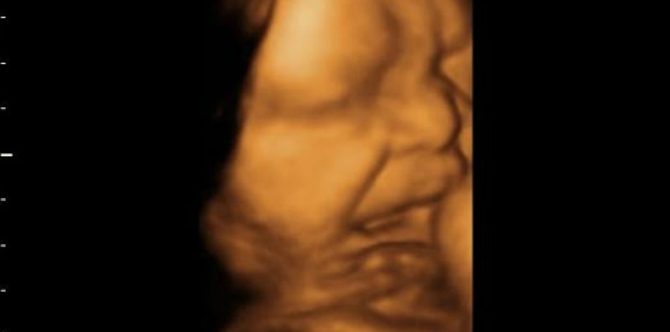Why do babies cry in the womb?