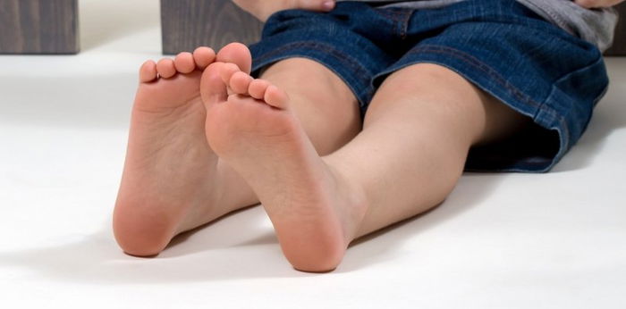Flat foot In Children: How to prevent and treat flat foot disadvantages