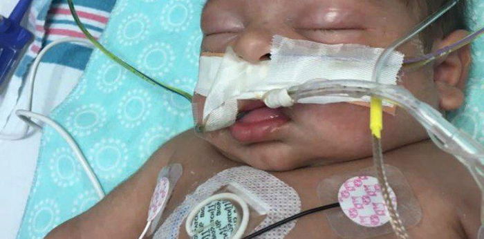 Newborn diagnosed with leukemia: cancer in newborns