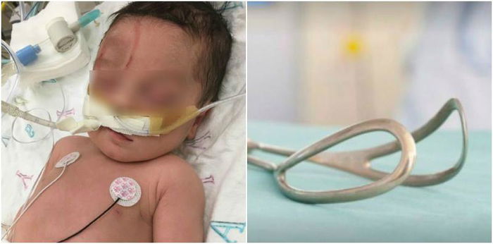 Grieving mom blames doctor's forceful forceps delivery for newborn's death
