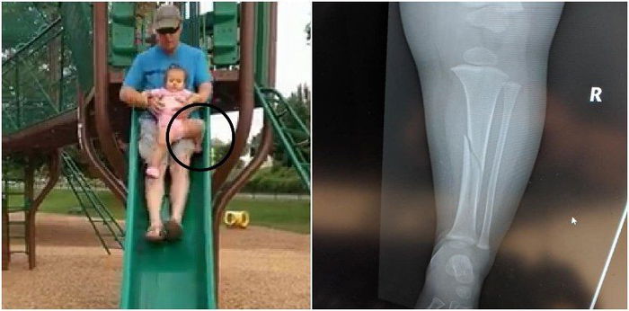 The danger of children wearing rubber shoes when going down slides