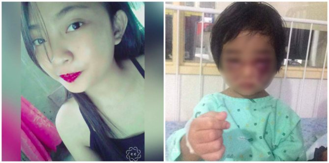 Depensa ng madrasta na diumano nambugbog: Nauntog ang bata