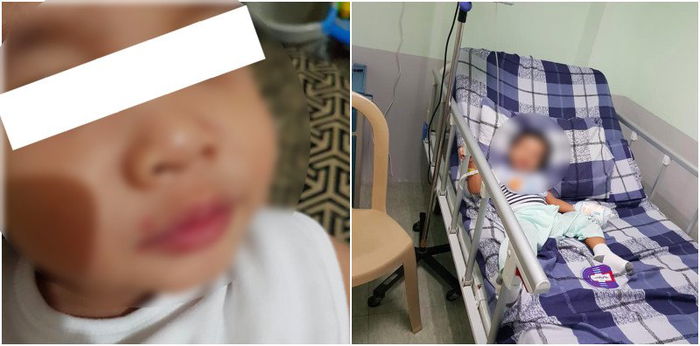 Baby nahawa ng herpes simplex virus dahil hinalikan