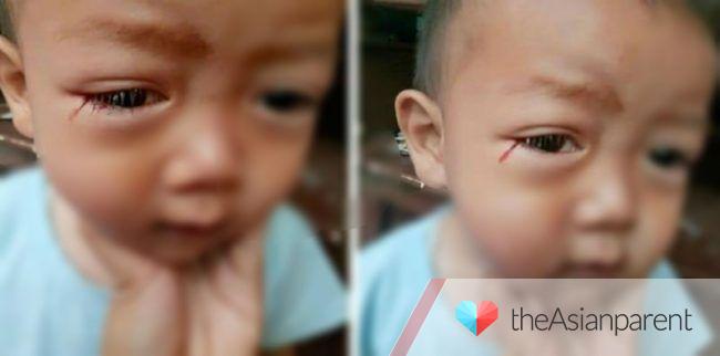 Bata, lumuluha ng dugo dahil sa labis na panonood sa cellphone?