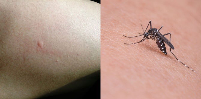 7 dahilan kung bakit madalas kang kagatin ng lamok