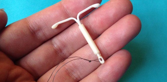 IUD: Lahat ng kailangan mong malaman tungkol sa contraceptive na ito