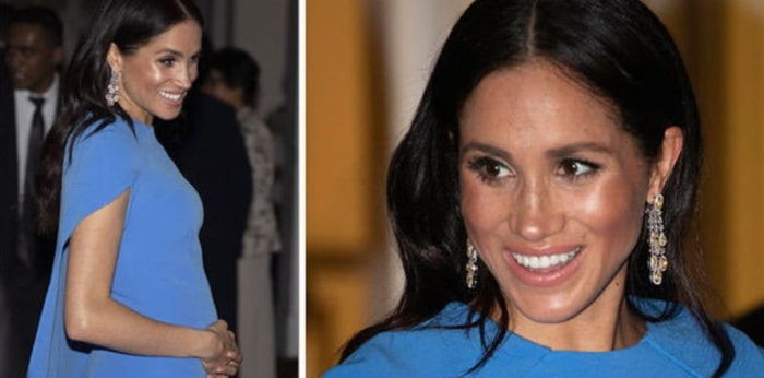 Meghan Markle's pregnancy comes with 20 baby doctors and 5-star treatment
