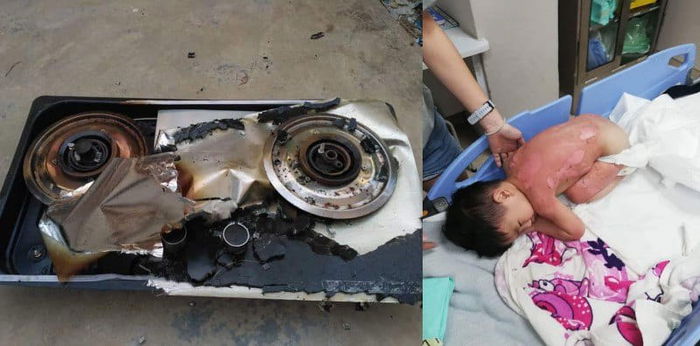 Gas stove explodes in woman's home, son suffers second-degree burns