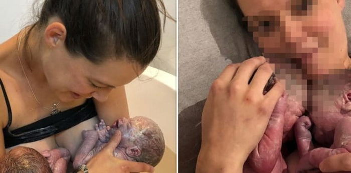 Midwife suspended after delivering premature twins at home birth