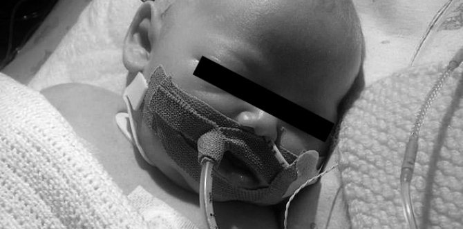 Isa nanamang sanggol ang namatay dahil sa halik