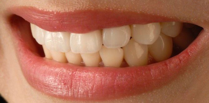 Rason kung bakit kailangan mag-toothbrush ng buntis at least twice a day