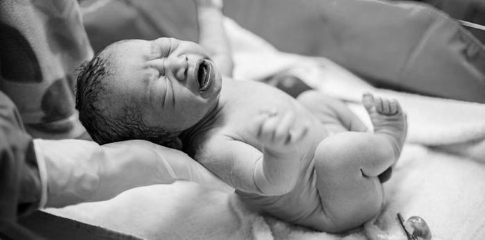 Meconium aspiration syndrome: Sanhi, sintomas, at lunas