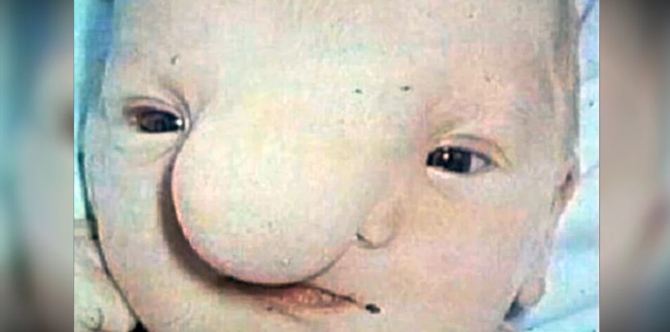 Baby gustong sanang iwan ng nanay sa ospital dahil "pangit" daw ito