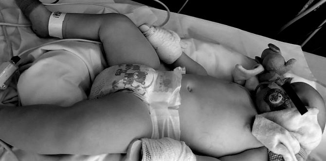 Halak ng 11-buwan baby, sintomas na pala ng nakamamatay na sepsis