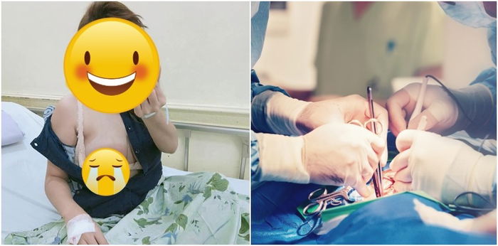 Breastfeeding mom na-operahan dahil sa mastitis at gamot sa mastitis