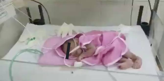 Sanggol na inabandona sa tambakan ng basura, naampon dahil sa social media