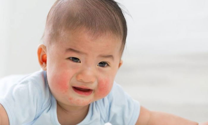 5 ways to prevent dry skin in babies