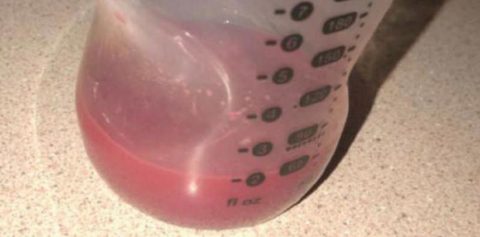 ALAMIN: Bakit naging kulay pink ang gatas ng isang ina?