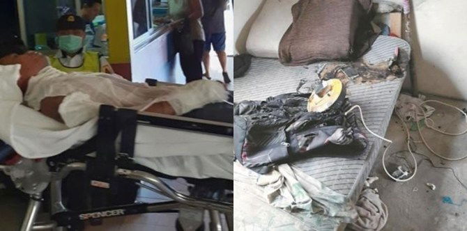 Sugatan ang isang lalaki dahil sa sumabog na cellphone