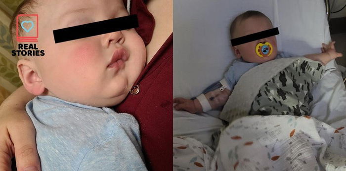 Baby, nag-positibo sa COVID-19 nang dalhin sa ospital dahil sa lagnat