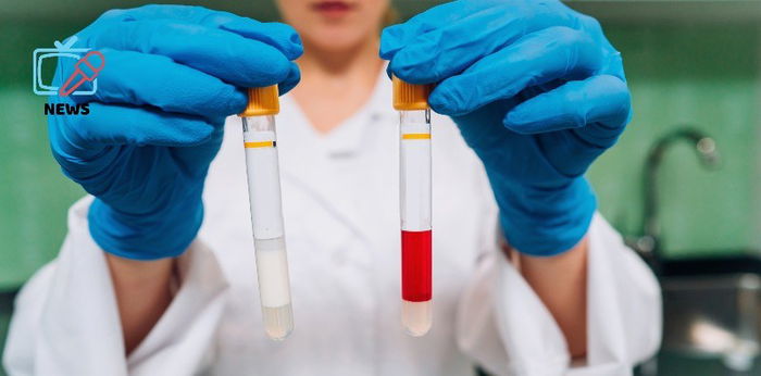COVID-19 nakita sa semen ng mga lalaking nag-positibo sa sakit