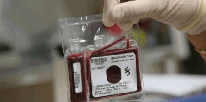 Anu-ano ang mga benepisyo ng cord blood banking?