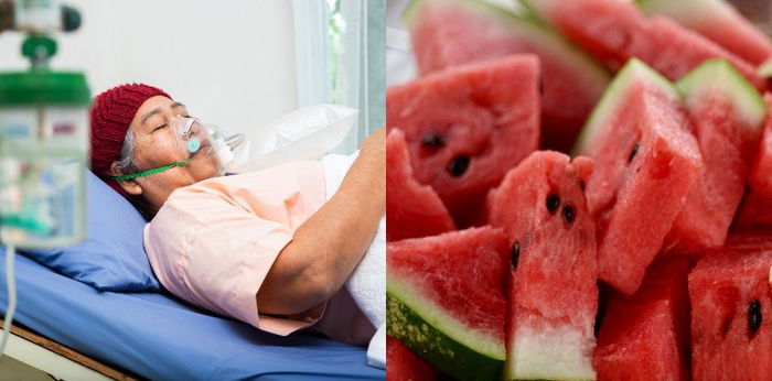 Babae muntik mamatay pagkatapos kumain ng watermelon na iniwan sa ref ng dalawang araw