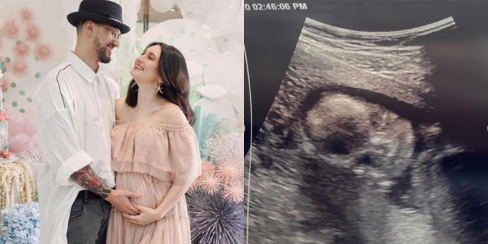 LOOK: It's a boy! Coleen Garcia at Billy Crawford inanunsyo na ang gender ng kanilang first baby