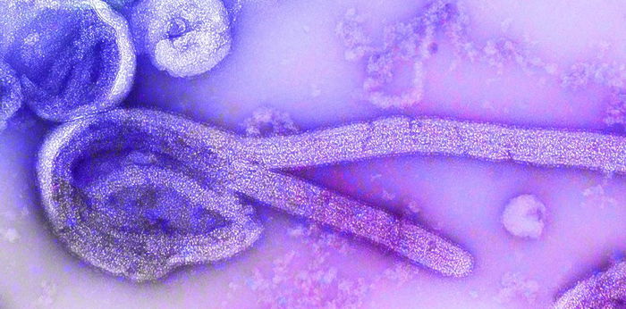 Ebola outbreak idineklara sa Congo, 5 na ang patay