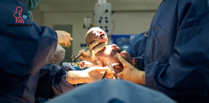 COVID-19 bihirang maipasa sa baby habang buntis, ayon sa pag-aaral