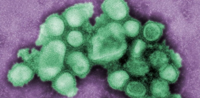 Bagong swine flu na nakita sa China, maaaring maging sanhi ng pandemic