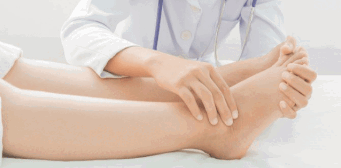 Pamamaga ng paa: Sanhi, gamot, at home remedy para dito