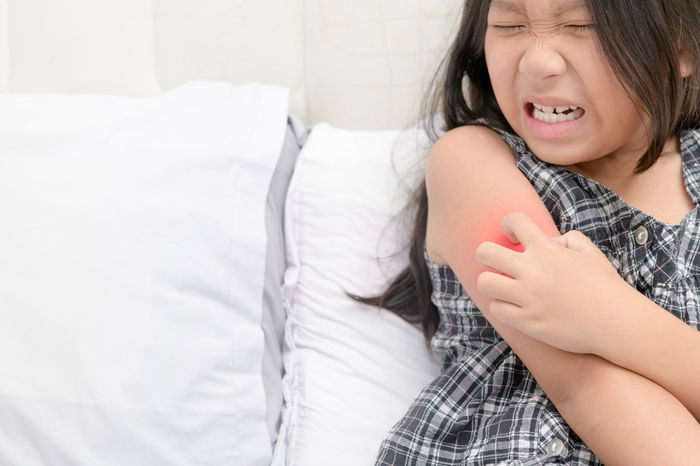 Don’t be Rash: 5 Ways to Prevent and Manage Eczema