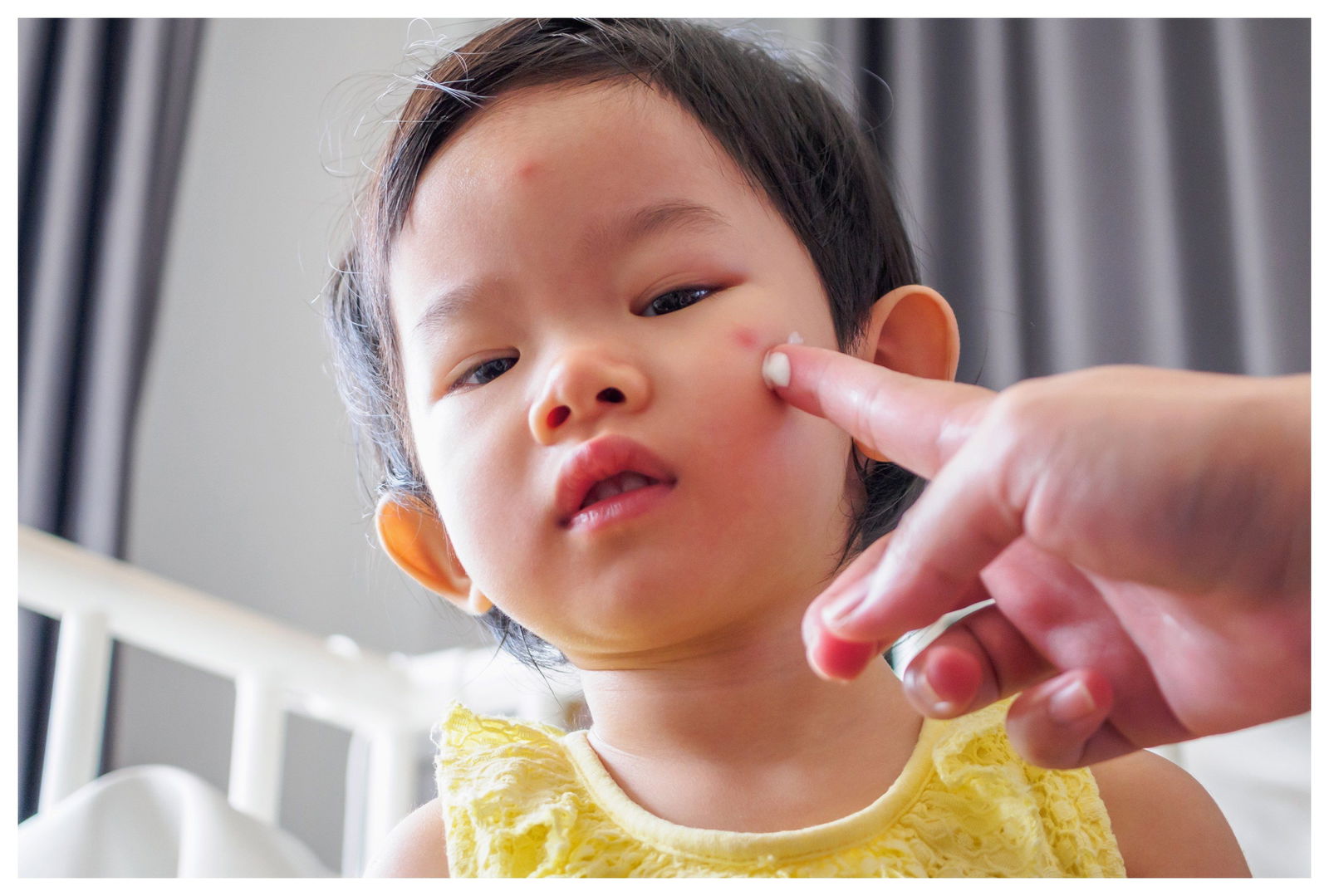 Don’t be Rash: 5 Ways to Prevent and Manage Eczema