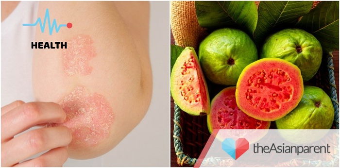 Dahon ng Bayabas para sa Eczema: Mabisa ba ito?