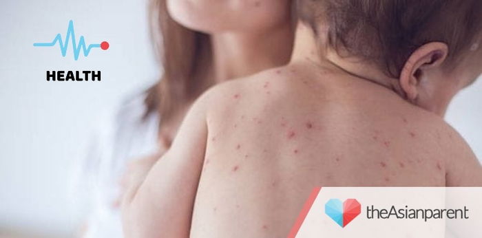 Can the MMR vaccine cause autism in kids? Here's the real truth