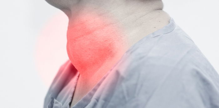 Gamot sa goiter at mga sintomas ng sakit sa thyroid na dapat mong malaman