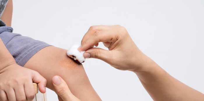 #AskDok: Ano ang dapat gawin kapag nasugatan o nagalusan ang bata?