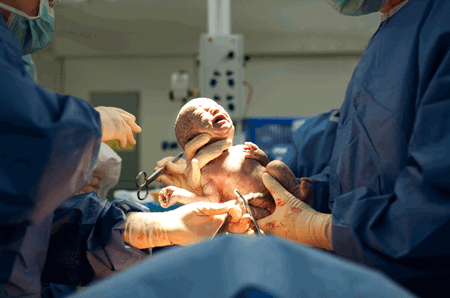 glucose tolerance test in pregnancy