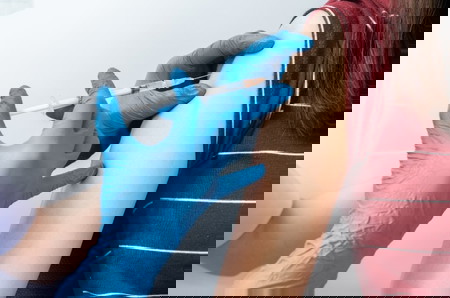 chicken pox in pregnancy