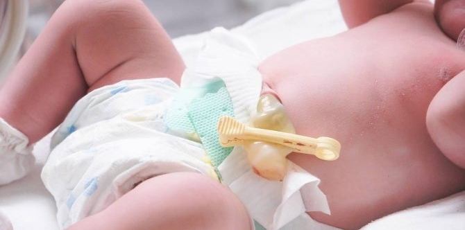 Pinapagsuot mo ba ng bigkis si baby? Here are 4 reasons why you shouldn't, according to pedias